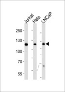 USP11 Antibody - Western blot of lysates from Jurkat, HeLa, LNCaP cell line (from left to right) using USP11 Antibody. Antibody was diluted at 1:1000 at each lane. A goat anti-mouse IgG H&L (HRP) at 1:3000 dilution was used as the secondary antibody. Lysates at 35 ug per lane.