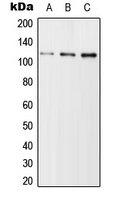 USP11 Antibody - Western blot analysis of USP11 expression in Jurkat (A); SP2/0 (B); H9C2 (C) whole cell lysates.