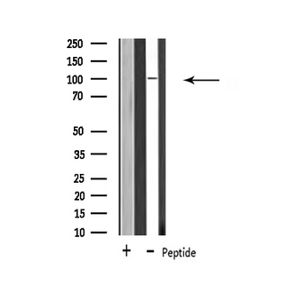 USP11 Antibody - Western blot analysis of extracts of 293 cells using USP11 antibody.