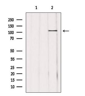 USP11 Antibody - Western blot analysis of extracts of mouse brain tissue using USP11 antibody. Lane 1 was treated with the blocking peptide.