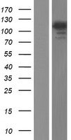 USP11 Protein - Western validation with an anti-DDK antibody * L: Control HEK293 lysate R: Over-expression lysate