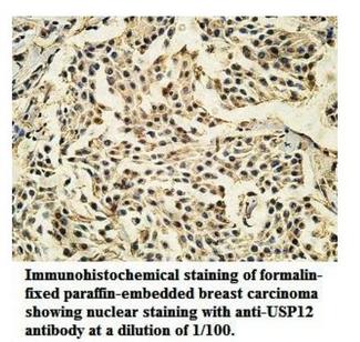 USP12 Antibody - Immunohistochemistry of USP12 antibody