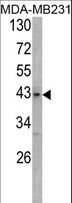USP12 Antibody - Western blot of USP12/USP46 Antibody in MDA-MB231 cell line lysates (35 ug/lane). USP12/USP46 (arrow) was detected using the purified antibody.