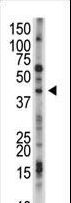 USP12 Antibody - The anti-USP12 antibody is used in Western blot to detect USP12 in mouse kidney tissue lysate.