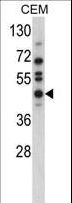 USP12 Antibody - Western blot of USP12 Antibody in CEM cell line lysates (35 ug/lane). USP12 (arrow) was detected using the purified antibody.