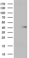 USP12 Antibody - HEK293T cells were transfected with the pCMV6-ENTRY control (Left lane) or pCMV6-ENTRY USP12 (Right lane) cDNA for 48 hrs and lysed. Equivalent amounts of cell lysates (5 ug per lane) were separated by SDS-PAGE and immunoblotted with anti-USP12.