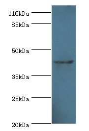 USP12 Antibody - Western blot. All lanes: USP12 antibody at 2 ug/ml+mouse liver tissue. Secondary antibody: goat polyclonal to rabbit at 1:10000 dilution. Predicted band size: 43 kDa. Observed band size: 43 kDa.  This image was taken for the unconjugated form of this product. Other forms have not been tested.
