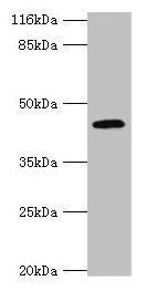 USP12 Antibody - Western blot All lanes: USP12 antibody at 2µg/ml + Mouse liver tissue Secondary Goat polyclonal to rabbit IgG at 1/10000 dilution Predicted band size: 43 kDa Observed band size: 43 kDa