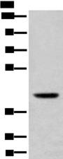 USP12 Antibody - Western blot analysis of Mouse liver tissue lysate  using USP12 Polyclonal Antibody at dilution of 1:700