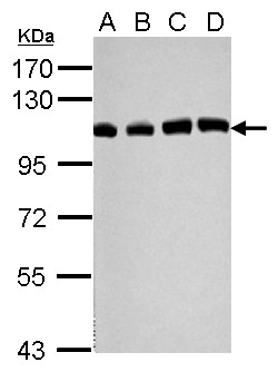 USP13 Antibody - Sample (30 ug of whole cell lysate) A: 293T B: A431 C: HeLa D: HepG2 7.5% SDS PAGE USP13 antibody diluted at 1:1000
