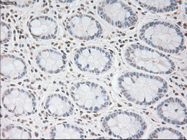 USP13 Antibody - Immunohistochemical staining of paraffin-embedded colon tissue using anti-USP13 mouse monoclonal antibody. (Dilution 1:50).