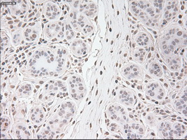 USP13 Antibody - Immunohistochemical staining of paraffin-embedded breast tissue using anti-USP13 mouse monoclonal antibody. (Dilution 1:50).