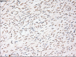 USP13 Antibody - Immunohistochemical staining of paraffin-embedded Ovary tissue using anti-USP13 mouse monoclonal antibody. (Dilution 1:50).