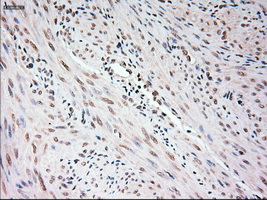 USP13 Antibody - Immunohistochemical staining of paraffin-embedded endometrium tissue using anti-USP13 mouse monoclonal antibody. (Dilution 1:50).