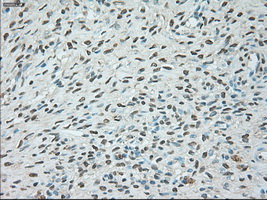 USP13 Antibody - Immunohistochemical staining of paraffin-embedded Ovary tissue using anti-USP13 mouse monoclonal antibody. (Dilution 1:50).