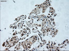 USP13 Antibody - Immunohistochemical staining of paraffin-embedded lung tissue using anti-USP13 mouse monoclonal antibody. (Dilution 1:50).