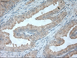 USP13 Antibody - Immunohistochemical staining of paraffin-embedded prostate tissue using anti-USP13 mouse monoclonal antibody. (Dilution 1:50).