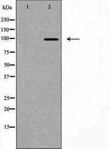 USP13 Antibody - Western blot analysis of extracts of mouse brain cells using USP13 antibody. The lane on the left is treated with the antigen-specific peptide.
