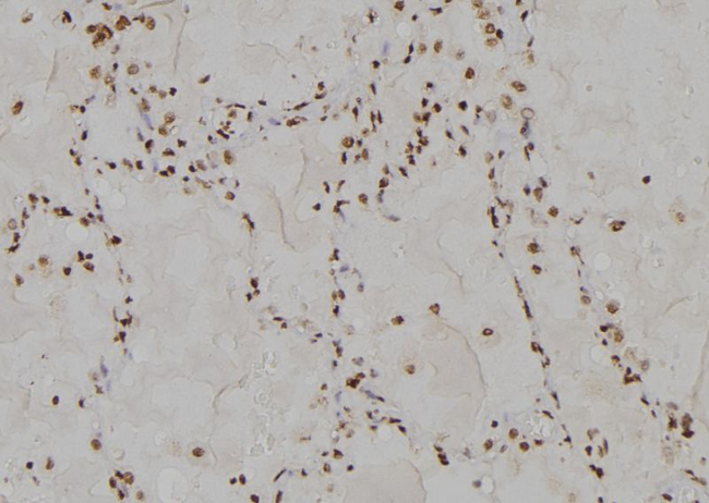 USP13 Antibody - 1:100 staining human tissue by IHC-P. The sample was formaldehyde fixed and a heat mediated antigen retrieval step in citrate buffer was performed. The sample was then blocked and incubated with the antibody for 1.5 hours at 22°C. An HRP conjugated goat anti-rabbit antibody was used as the secondary.