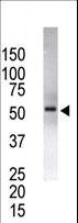 USP14 Antibody - The anti-USP14 antibody is used in Western blot to detect USP14 in USP14-transfected HeLa cell lysates. Transfection data is kindly provided by Dr. B. Pierrat from the Novartis Institute for Biomedical Research (Basel, Switzerland).