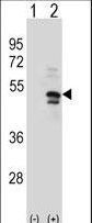 USP14 Antibody - Western blot of USP14 (arrow) using rabbit polyclonal USP14 Antibody (K7). 293 cell lysates (2 ug/lane) either nontransfected (Lane 1) or transiently transfected (Lane 2) with the USP14 gene.