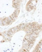USP14 Antibody - Detection of Human USP14 by Immunohistochemistry : Formalin-Fixed, Paraffin-Embedded (FFPE)