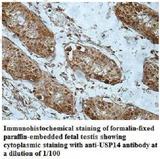 USP14 Antibody - Immunohistochemistry of USP14 antibody