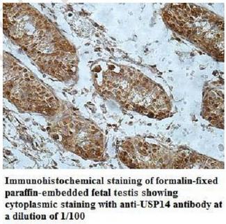 USP14 Antibody - Immunohistochemistry of USP14 antibody