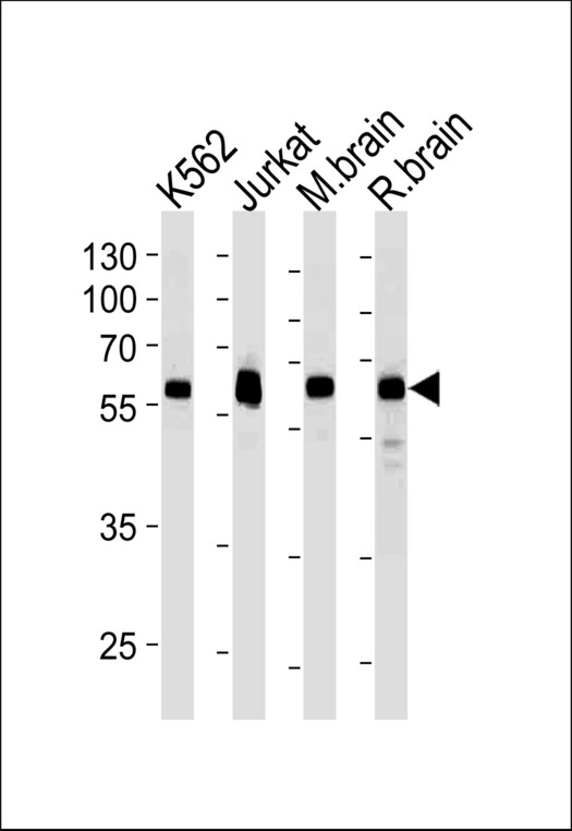 USP14 Antibody - USP14 Antibody western blot of k562,Jurkat cell line ,mouse brain and rat brain tissue lysates (35 ug/lane). The USP14 antibody detected the USP14 protein (arrow).