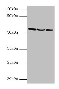 USP14 Antibody - Western blot All lanes: Ubiquitin carboxyl-terminal hydrolase 14 antibody at 2µg/ml Lane 1: Hela whole cell lysate Lane 2: 293T whole cell lysate Lane 3: NIH/3T3 whole cell lysate Secondary Goat polyclonal to rabbit IgG at 1/10000 dilution Predicted band size: 57, 53, 55 kDa Observed band size: 57 kDa