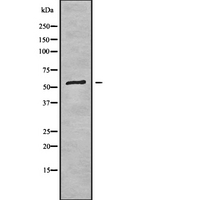 USP14 Antibody - Western blot analysis USP14 using Jurkat whole cells lysates