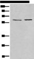 USP14 Antibody - Western blot analysis of A172 and Jurkat cell lysates  using USP14 Polyclonal Antibody at dilution of 1:400