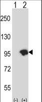USP15 Antibody - Western blot of USP15 (arrow) using rabbit polyclonal USP15 Antibody. 293 cell lysates (2 ug/lane) either nontransfected (Lane 1) or transiently transfected (Lane 2) with the USP15 gene.