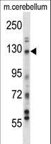 USP15 Antibody - USP15 Antibody western blot of mouse cerebellum tissue lysates (35 ug/lane). The USP15 antibody detected the USP15 protein (arrow).