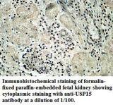 USP15 Antibody