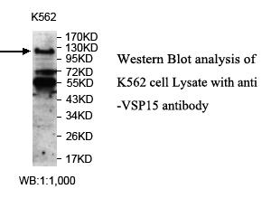 USP15 Antibody