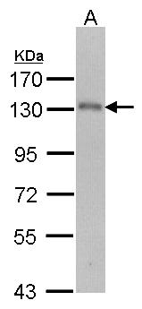 USP15 Antibody - Sample (30 ug of whole cell lysate). A: Molt-4 . 7.5% SDS PAGE. USP15 antibody diluted at 1:1000.
