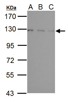 USP15 Antibody - Sample (30 ug of whole cell lysate). A: NIH-3T3, B: JC, C: BCL-1. 7.5% SDS PAGE. USP15 antibody diluted at 1:1000.