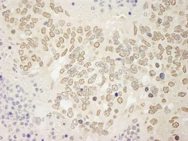 USP15 Antibody - Detection of Mouse USP15 by Immunohistochemistry. Sample: FFPE section of mouse teratoma. Antibody: Affinity purified rabbit anti-USP15 used at a dilution of 1:100. Epitope Retrieval Buffer-High pH (IHC-101J) was substituted for Epitope Retrieval Buffer-Reduced pH.