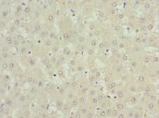 USP15 Antibody - Immunohistochemistry of paraffin-embedded human liver tissue at dilution 1:100
