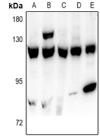 USP15 Antibody - Western blot analysis of USP15 expression in A549 (A), SKOVCAR3 (B), HEK293T (C), H9C2 (D), AML12 (E) whole cell lysates.