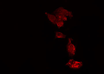 USP15 Antibody - Staining HeLa cells by IF/ICC. The samples were fixed with PFA and permeabilized in 0.1% Triton X-100, then blocked in 10% serum for 45 min at 25°C. The primary antibody was diluted at 1:200 and incubated with the sample for 1 hour at 37°C. An Alexa Fluor 594 conjugated goat anti-rabbit IgG (H+L) antibody, diluted at 1/600, was used as secondary antibody.