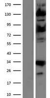 USP15 Protein - Western validation with an anti-DDK antibody * L: Control HEK293 lysate R: Over-expression lysate