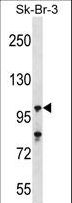 USP16 Antibody - USP16 Antibody western blot of SK-BR-3 cell line lysates (35 ug/lane). The USP16 antibody detected the USP16 protein (arrow).