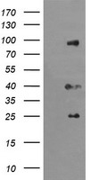 USP16 Antibody - E.coli lysate (5 ug, left lane) and E.coli lysate expressing human recombinant protein fragment (5 ug, right lane) corresponding to amino acids 137-466 of human USP16(NP_001001992) were separated by SDS-PAGE and immunoblotted with anti-USP16.