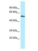 USP17L2 / DUB3 Antibody - USP17L5 antibody Western Blot of HeLa. Antibody dilution: 1 ug/ml.  This image was taken for the unconjugated form of this product. Other forms have not been tested.