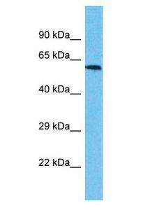 USP17L3 Antibody - USP17L3 antibody Western Blot of Jurkat. Antibody dilution: 1 ug/ml.  This image was taken for the unconjugated form of this product. Other forms have not been tested.