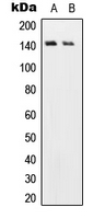 USP19 Antibody - Western blot analysis of USP19 expression in Jurkat (A); H9C2 (B) whole cell lysates.