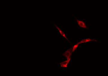 USP19 Antibody - Staining NIH-3T3 cells by IF/ICC. The samples were fixed with PFA and permeabilized in 0.1% Triton X-100, then blocked in 10% serum for 45 min at 25°C. The primary antibody was diluted at 1:200 and incubated with the sample for 1 hour at 37°C. An Alexa Fluor 594 conjugated goat anti-rabbit IgG (H+L) antibody, diluted at 1/600, was used as secondary antibody.