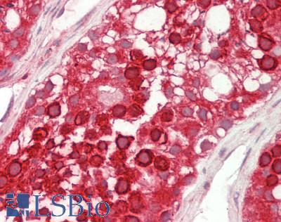 USP2 Antibody - Human Testis: Formalin-Fixed, Paraffin-Embedded (FFPE).  This image was taken for the unconjugated form of this product. Other forms have not been tested.
